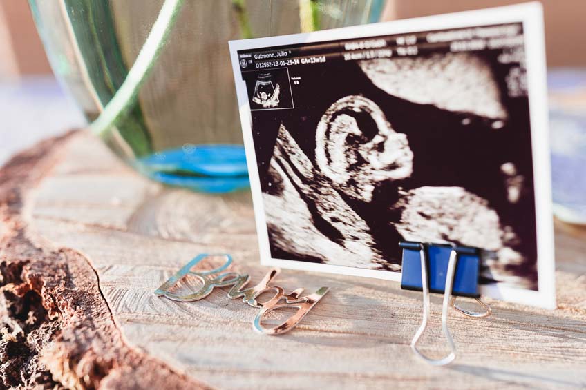 Dein Baby feiert mit! Ultraschallbilder sind eine tolle Deko und übermitteln die Frohe Botschaft © juliafashionblonde